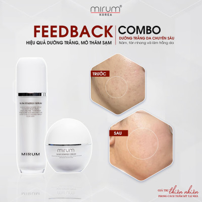 Kem dưỡng trắng da, mờ nám & tàn nhang Mirum 55ml– Mirum Glow Synergy Cream